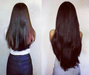 Antes e Depois Luminus